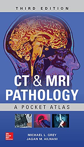Ct  Mri Pathology A Pocket Atlas (Michael L Grey, Jagan Mohan Ailinani)