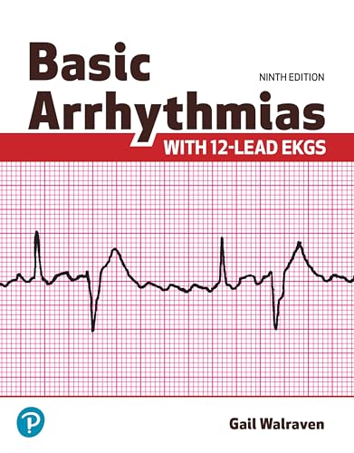 Basic Arrhythmias