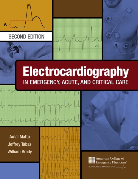 Electrocardiography In Emergency, Acute, And Critical Care (Facep Amal Mattu, Md, Facep Jeffrey A. Tabas Etc.