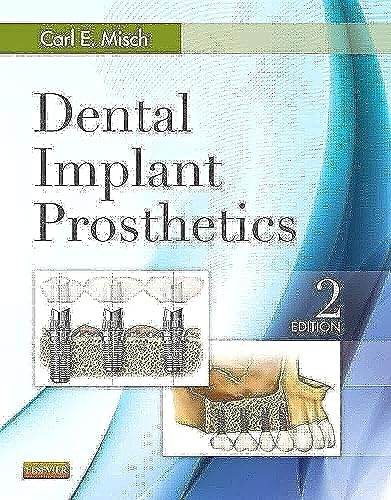 Dental Implant Prosthetics, 2e [HARDCOVER] [2014] [By Carl E ...